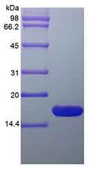 Recombinant Rat Glia Maturation Factor beta