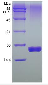 Recombinant Human Transmembrane Activator and CAML Interactor/TNFRSF13B