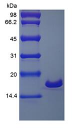 Recombinant Human Interleukin-1 beta
