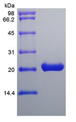 Recombinant Murine Cardiotrophin­1