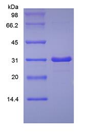 Recombinant Human Insulin-like Growth Factor-Binding Protein 7