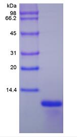 Recombinant Human Growth Regulated Protein-alpha/CXCL1