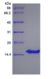 Recombinant Human Stromal-Cell Derived Factor-1 gamma/CXCL12 gamma