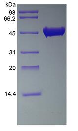 Recombinant Streptokinase