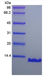 Recombinant Human Parathyroid Hormone 7-84