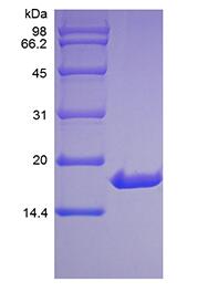 Recombinant Human Interleukin-33