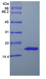 Recombinant Human Interleukin-20