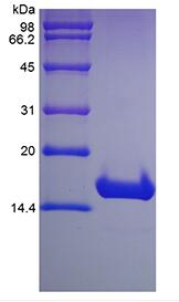 Recombinant Human Cyclin-Dependent Kinase Inhibitor 2A, Isoform 1