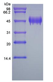 Recombinant Human Pigment Epithelium-derived Factor