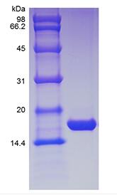 Recombinant Human Glia Maturation Factor beta