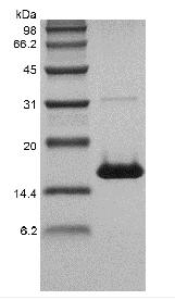 Recombinant Human soluble CD40 Ligand/TNFSF5
