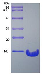 Recombinant Human Parathyroid Hormone 1-84