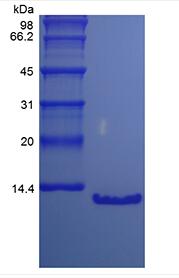 Recombinant Human Parathyroid Hormone 7-84, 15N Stable Isotope Labeled