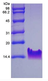 Recombinant Human Thymosin beta 4