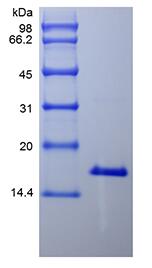 Recombinant Human Interleukin-21