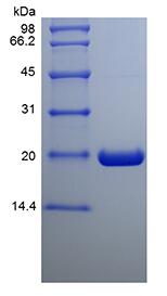 Recombinant Human Ubiquitin-conjugating Enzyme E2 C, His