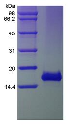 Recombinant Human Exodus-2/CCL21