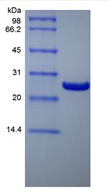Recombinant Human B-cell Lymphoma-extra Large