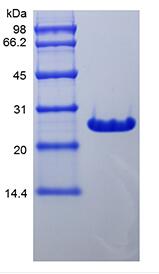 Recombinant Murine B-cell Lymphoma-extra Large