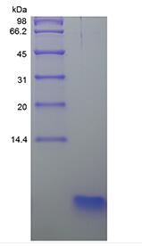 Recombinant Human Parathyroid Hormone 7-34