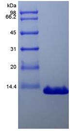 Recombinant Human Parathyroid Hormone-related Protein