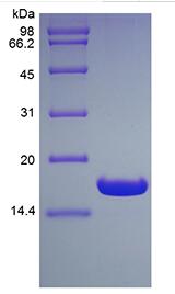 Recombinant Human Ubiquitin-conjugating Enzyme E2 B, His