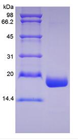 Recombinant Human Mesencephalic Astrocyte-Derived Neurotrophic Factor