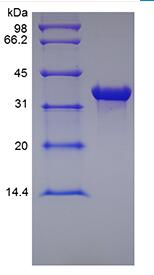 Recombinant Human MHC Class I Polypeptide-Related Sequence A