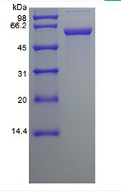 Recombinant Human Protein Disulfide Isomerase