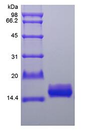 Recombinant Human Interleukin-36 Receptor Antagonist Protein