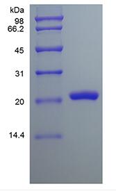 Recombinant Human Fibroblast Growth Factor 9