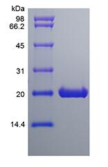 Recombinant Rat Ciliary Neurotrophic Factor
