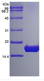 Recombinant Human Interleukin-7