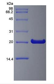 Recombinant Human Fibroblast Growth Factor 21
