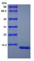 Recombinant Human Apolipoprotein-Serum Amyloid A1