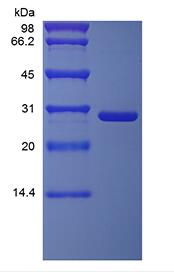 Recombinant Murine soluble Tumor Necrosis Factor Receptor Type II/TNFRSF1B