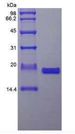 Recombinant Human Interleukin-36 gamma, 169a.a.