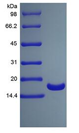 Recombinant Human Tumor Necrosis Factor-alpha/TNFSF2, His