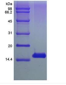 Recombinant Human Thymic Stromal Lymphopoietin