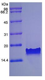 Recombinant Murine Thymus Expressed Chemokine/CCL25