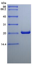 Recombinant Rat Cardiotrophin-1