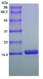 Recombinant Human Melanoma Inhibitor Activity Protein 2
