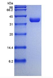 Recombinant Human Erythropoietin alpha, Liquid