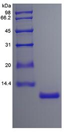 Recombinant Human Interleukin-15