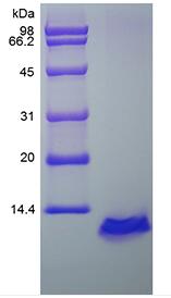 Recombinant Human Regulation upon Activation Normal T cell Express Sequence/CCL5