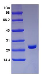 Recombinant Human soluble Receptor Activator of Nuclear Factor kappa-B Receptor/