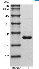 Recombinant Human Interleukin-1 beta GMP