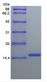 Recombinant Human Leptin