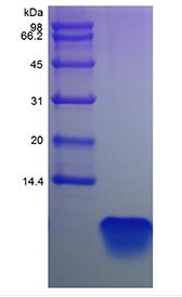 Recombinant Human Parathyroid Hormone 1-34