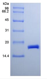 Recombinant Murine Cerebral Dopamine Neurotrophic Factor